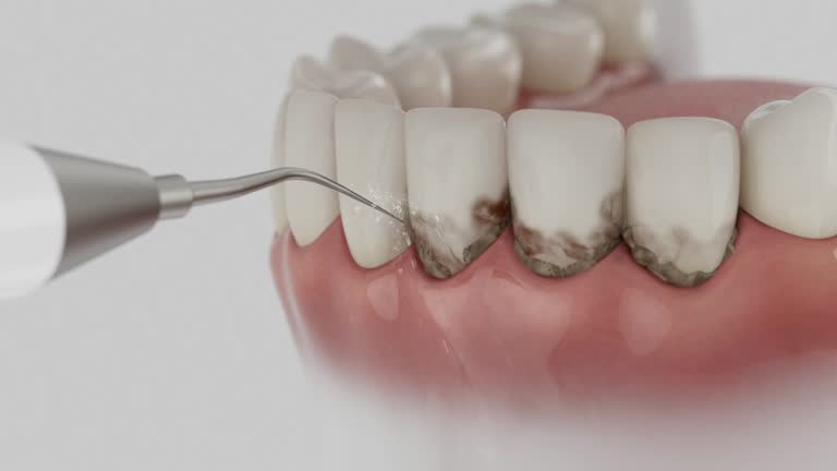 Trusted Tooth Extraction service in University Park, TX - Dentist Open Now